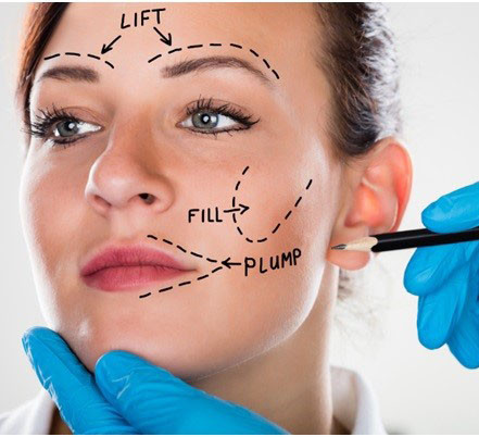 Lipofilling du Visage