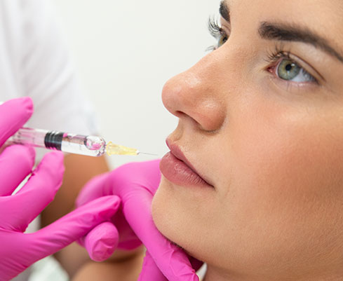 Lipofilling du Visage